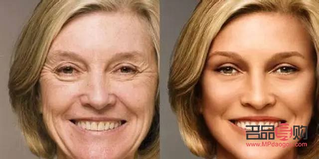 眼睛下面皺紋怎么去除最有效果