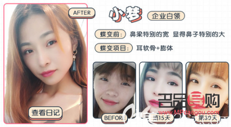 非凡美容怎么樣(非凡美容怎么樣可靠嗎)