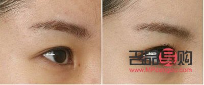 <h3>如何讓內(nèi)雙眼皮變外雙眼皮呢</h3>