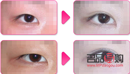 <h3>一單一雙可以做雙眼皮手術(shù)嗎？</h3>