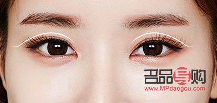 <h3>一單一雙可以做雙眼皮手術(shù)嗎？</h3>