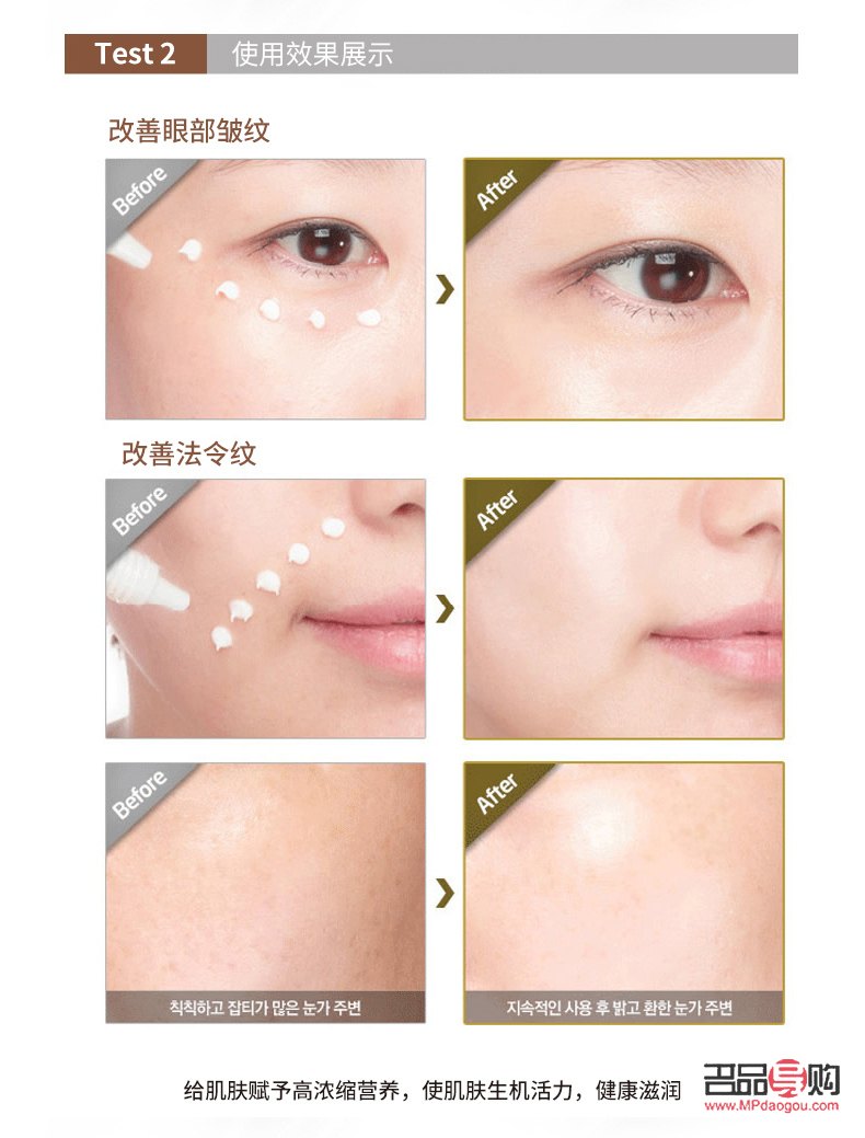<h3>怎樣淡化淚溝和眼袋</h3>