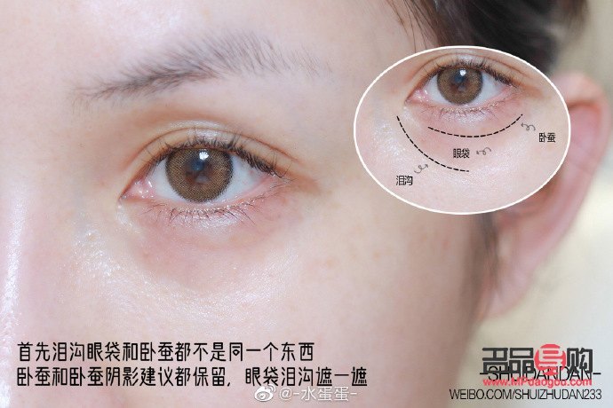 怎樣淡化淚溝和眼袋