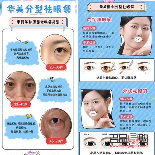 眼袋修復(fù)專(zhuān)家排名(眼袋修復(fù)專(zhuān)家排名)