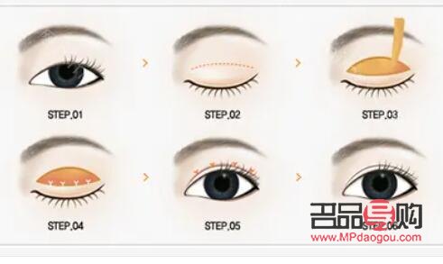 <h3>割雙眼皮1萬(wàn)6是否貴？全面解析雙眼皮手術(shù)價(jià)格與價(jià)值</h3>