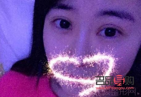 割雙眼皮圖片恢復圖記錄：美麗蛻變的詳細日志