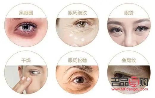 眼部抗衰項(xiàng)目有哪些(眼部抗衰項(xiàng)目有哪些項(xiàng)目)