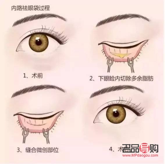 眼綜合是做什么項(xiàng)目(眼綜合是做哪些項(xiàng)目)