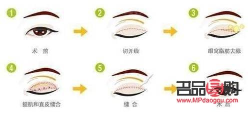 眼綜合是做什么項(xiàng)目(眼綜合是做哪些項(xiàng)目)