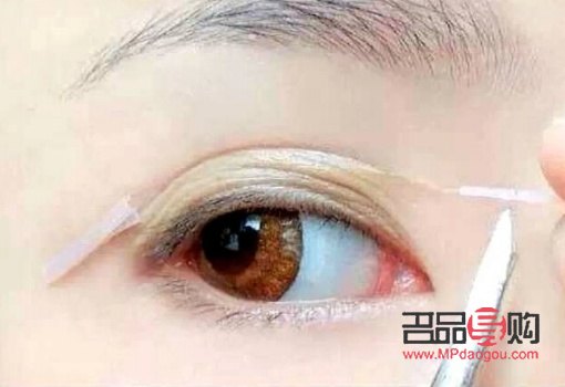 上眼皮松適合做什么樣的雙眼皮(上眼皮松適合做什么樣的雙眼皮手術(shù))