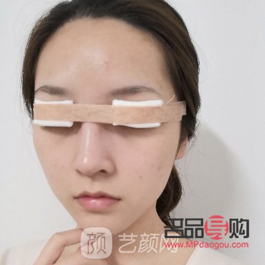 <h3>眼輪匝肌折疊臥蠶再造——上海九院打造迷人電眼新選擇</h3>