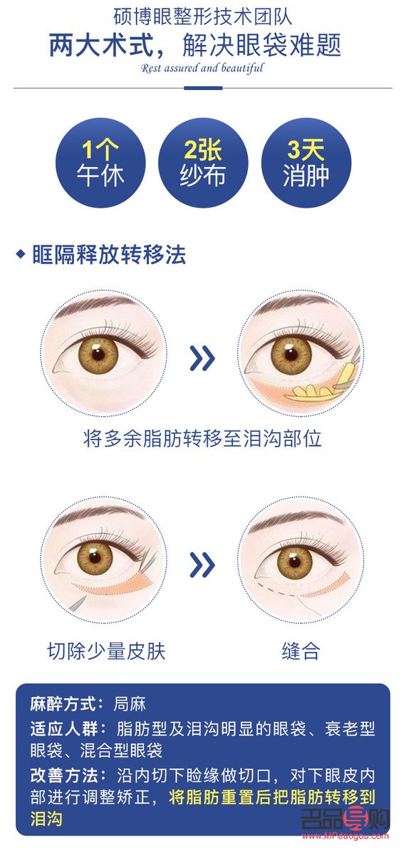 眼輪匝肌折疊臥蠶再造——上海九院打造迷人電眼新選擇