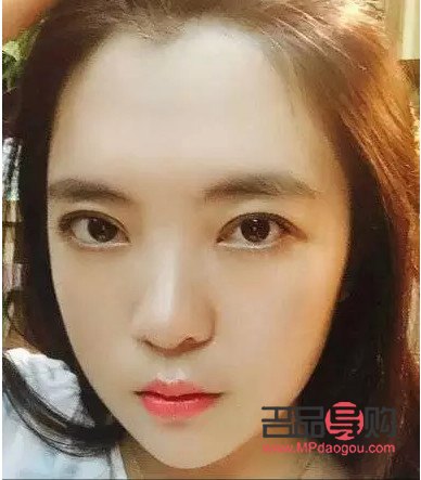 納米雙眼皮和埋線雙眼皮的區(qū)別(納米雙眼皮和埋線雙眼皮的區(qū)別是什么)