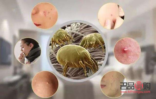做美容去螨蟲嗎(做美容去螨蟲嗎有效果嗎)