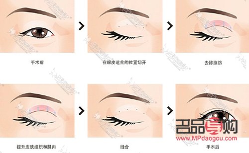 <h3>眼綜合全部項(xiàng)目詳解：打造迷人電眼</h3>