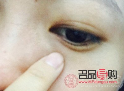 眼皮下垂怎么自然恢復(fù)吃什么好(眼皮下垂怎么做會(huì)改善)