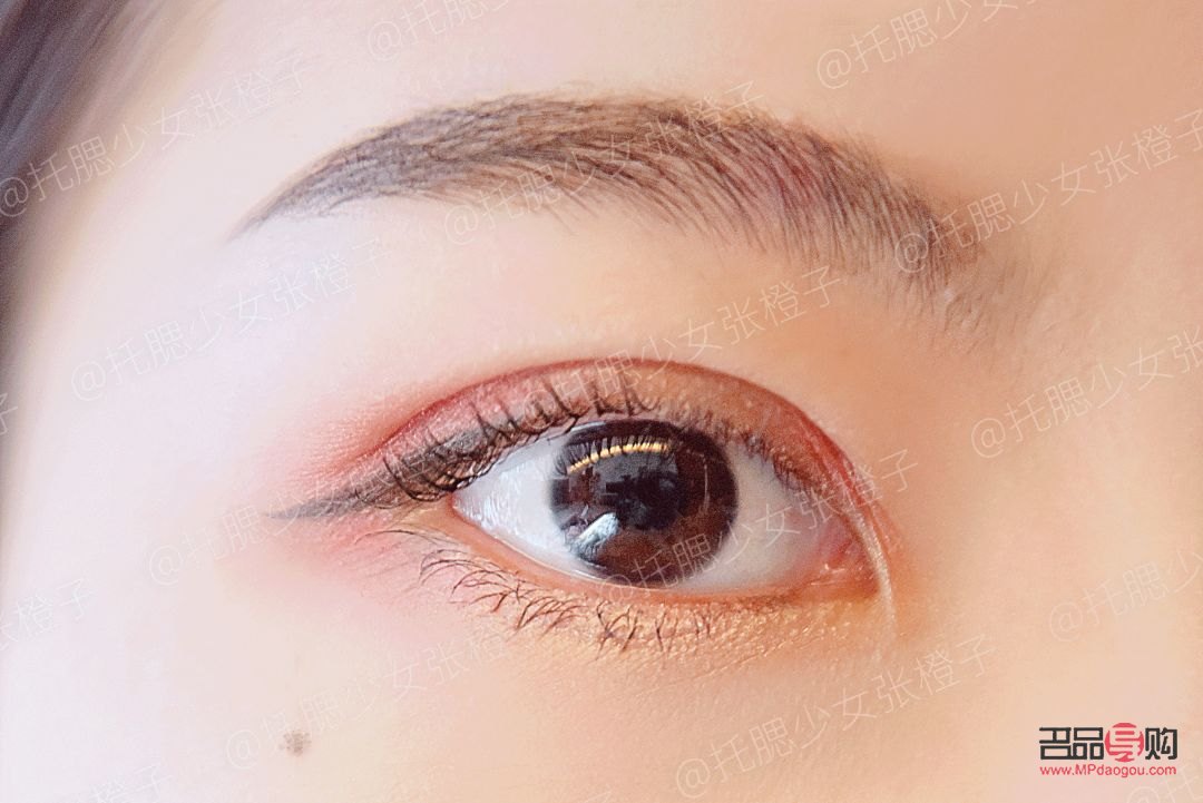 <h3>雙眼皮手術(shù)哪種最好看</h3>