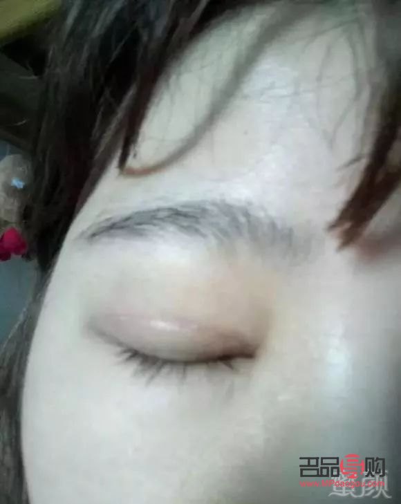 <h3>翹睫術(shù)雙眼皮能保持多久恢復(fù)</h3>