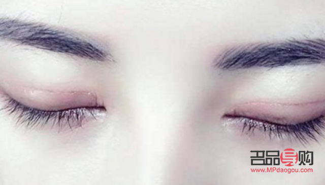 全切雙眼皮手術(shù)過(guò)程視頻(全切雙眼皮手術(shù)過(guò)程視頻真人圖片)