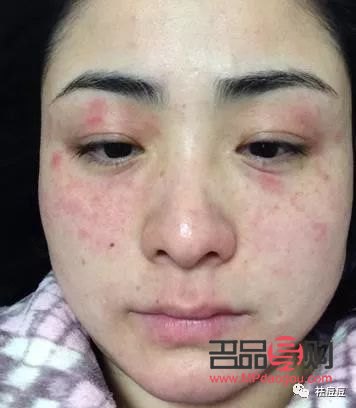 怎么測彩妝過敏了(怎么測彩妝過敏了呢)