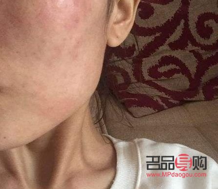 怎么測(cè)彩妝過敏了(怎么測(cè)彩妝過敏了呢)