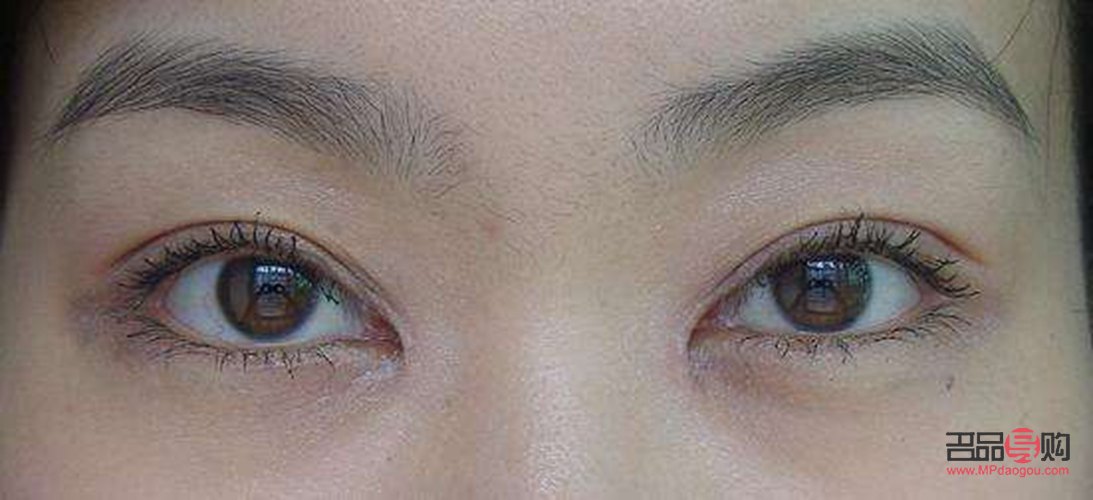 小眼睛開(kāi)眼角雙眼皮效果圖大全(小眼睛開(kāi)眼角雙眼皮效果圖大全圖片)