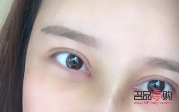小眼睛開(kāi)眼角雙眼皮效果圖大全(小眼睛開(kāi)眼角雙眼皮效果圖大全圖片)