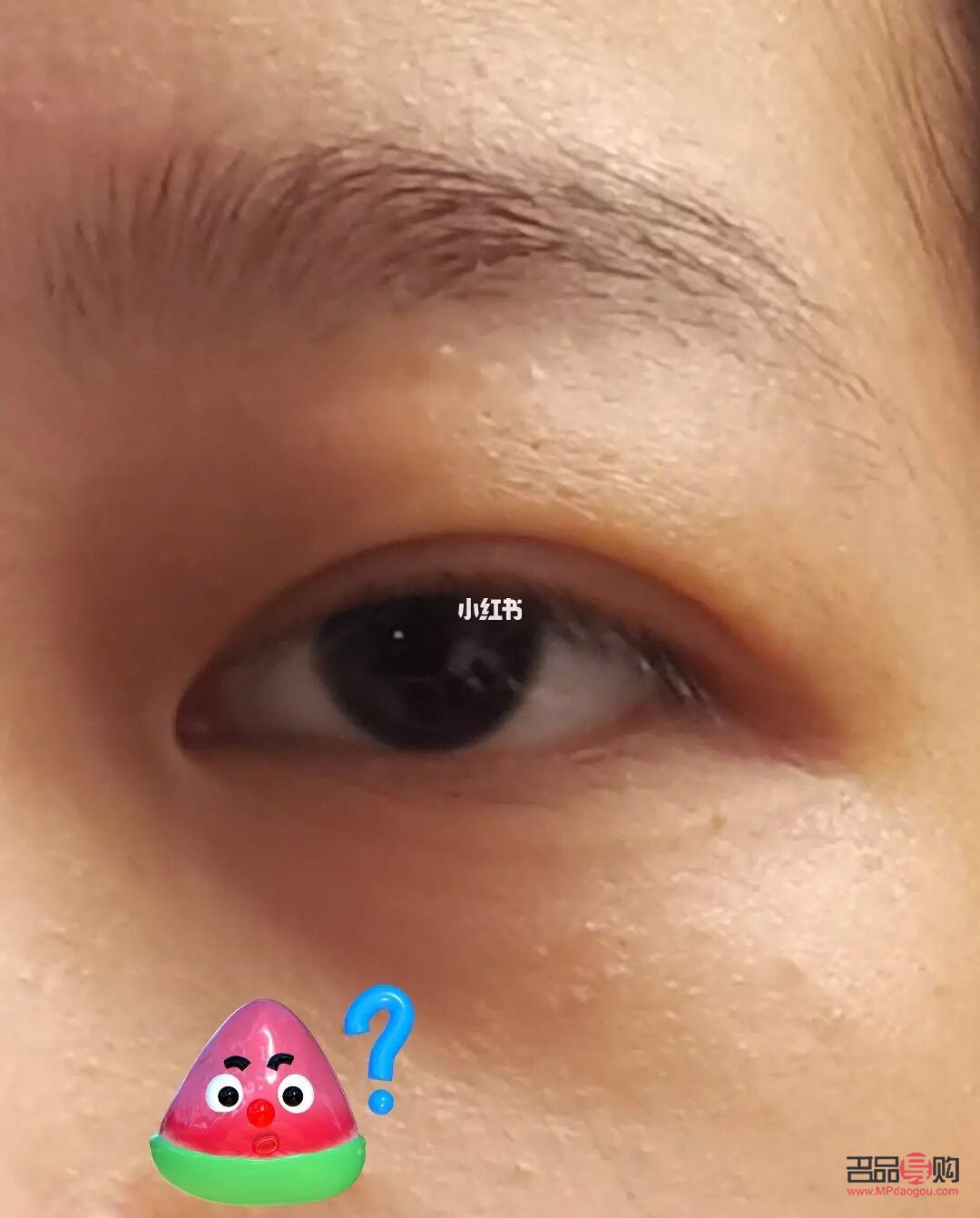 兒童腫眼泡怎么消除最快方法(兒童腫眼泡怎么消除最快方法圖解)