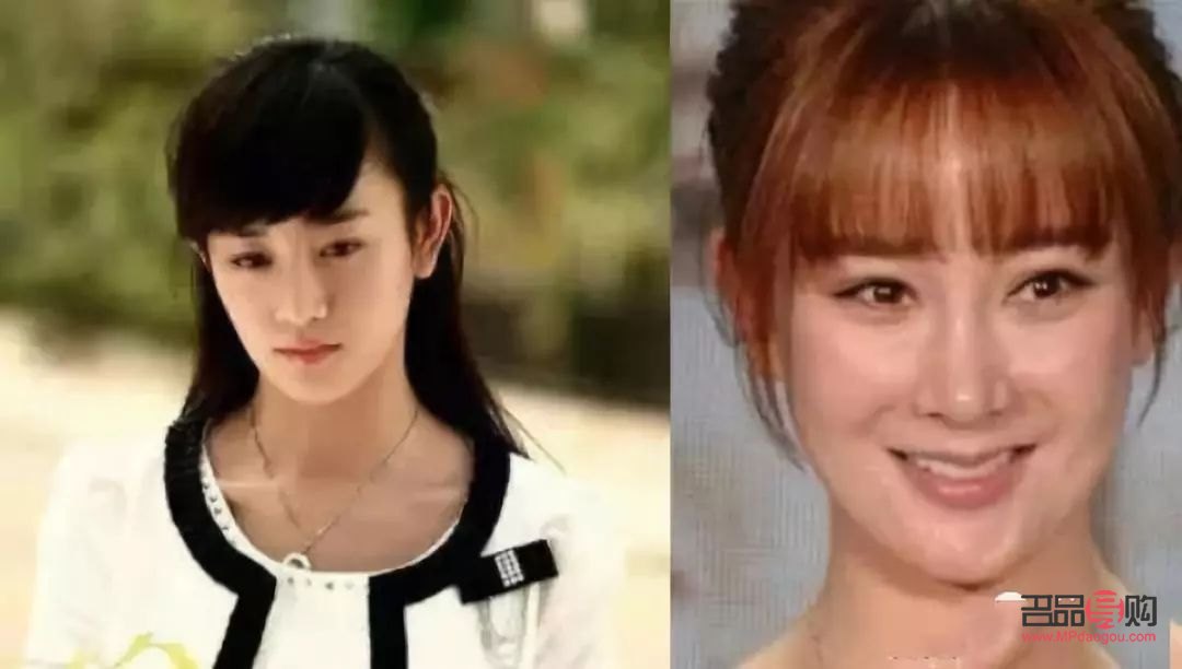 5g桃花眼雙眼皮恢復(fù)期多久(5g桃花眼雙眼皮能管多久)