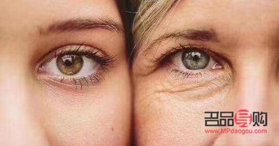 <h3>眼皮下垂缺什么營養(yǎng)</h3>