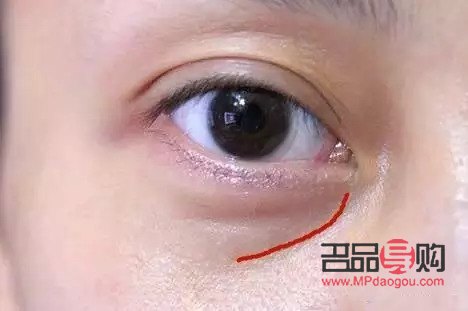 <h3>單獨(dú)開眼角需要多少錢？詳解價(jià)格因素及注意事項(xiàng)</h3>