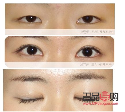 做的雙眼皮和自然的區(qū)別(做的雙眼皮和自然的區(qū)別是什么)
