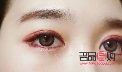 一內(nèi)雙一外雙眼的幾率(一內(nèi)雙一外雙是什么眼)