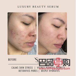 <h3>學(xué)美容要皮膚好嗎</h3>