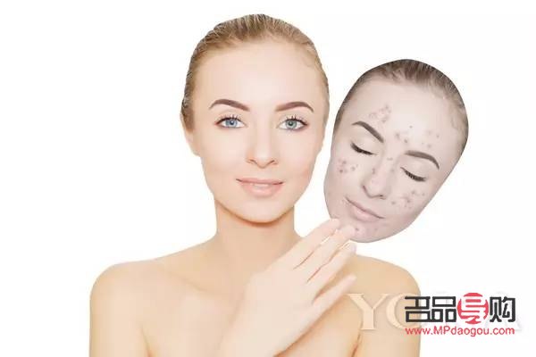 <h3>美容院祛斑好嗎？專業(yè)解析與選擇建議</h3>