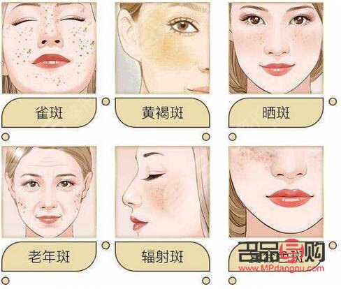 <h3>美容院祛斑好嗎？專業(yè)解析與選擇建議</h3>