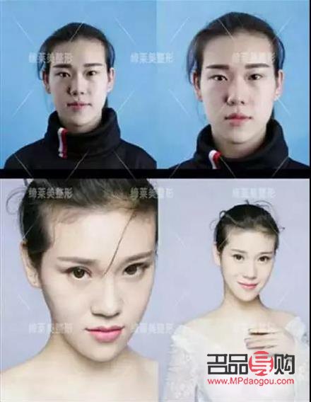 雙眼皮哪種形態(tài)好看(雙眼皮哪種形態(tài)好看一點(diǎn))