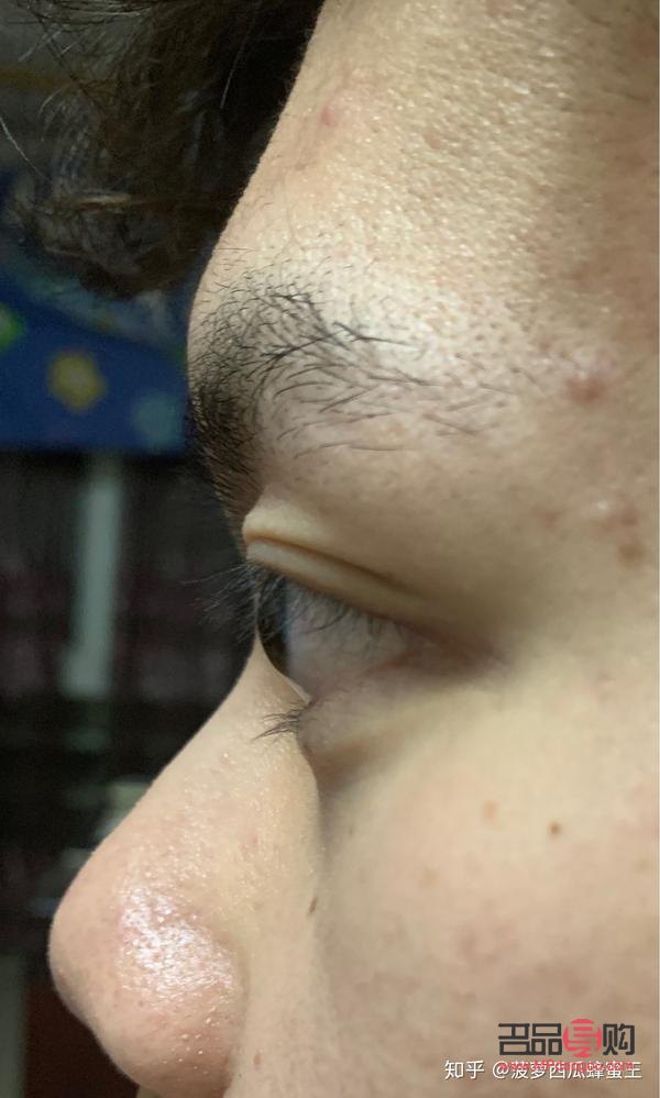 眼凸的圖片(眼凸的圖片大全)