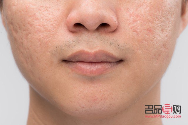 掌握面部美容技巧，煥發(fā)自然光彩