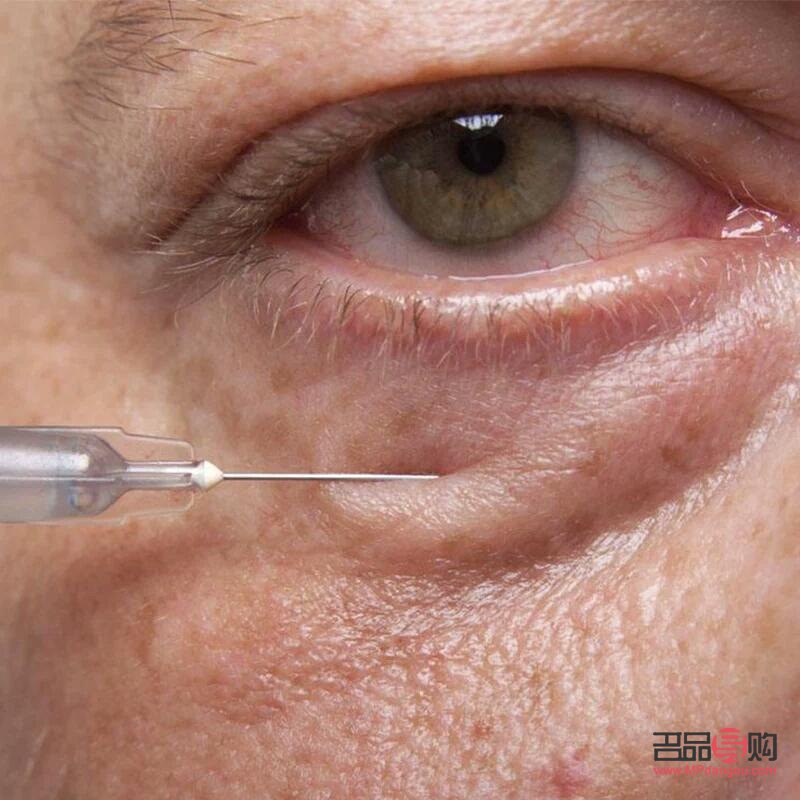 怎么消除眼袋最有效的辦法(怎么消除眼袋最有效的辦法松弛)