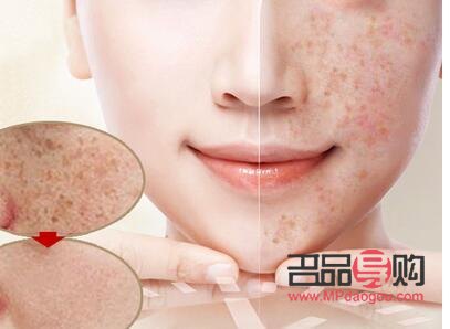 <h3>岫巖美容祛斑大揭秘：哪家才是你的最佳選擇？</h3>