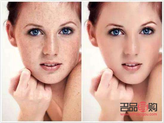 <h3>岫巖美容祛斑大揭秘：哪家才是你的最佳選擇？</h3>