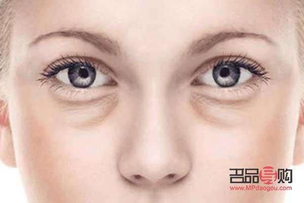 自己去眼袋的絕招(消除眼袋的最有效方法)