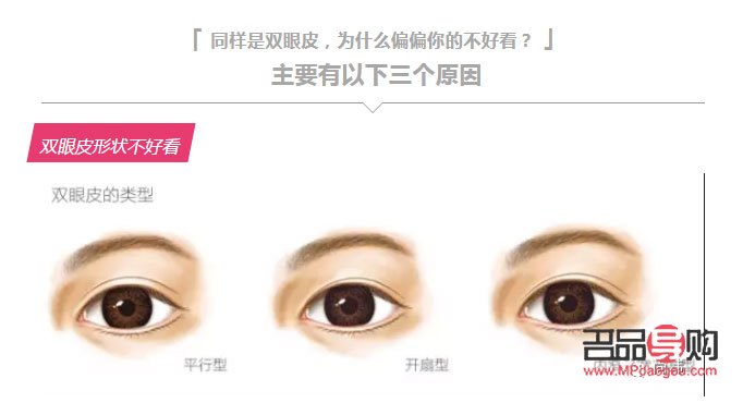 新月型雙眼皮好看嗎(新月型雙眼皮好看嗎圖片)