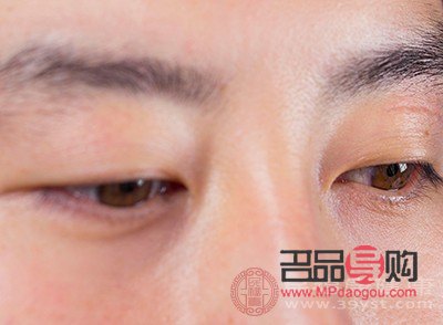 眼部神經痙攣能自愈嗎(眼部神經痙攣能自愈嗎吃什么藥)