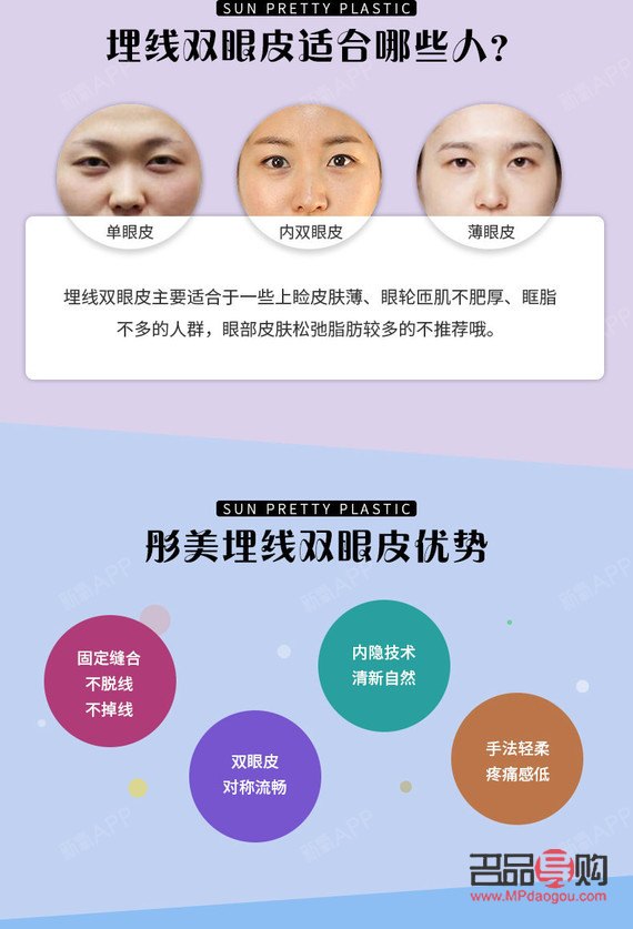 松解雙眼皮，打造自然明眸