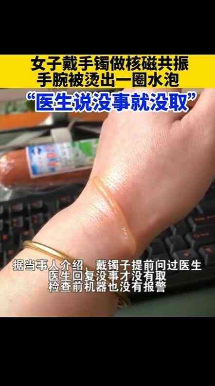 女人長(zhǎng)期戴金手鐲的好處(今年最火的黃金手鐲)