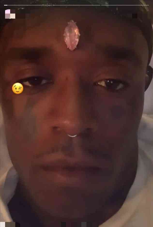 粉鉆鑲在腦門上(粉鉆鑲在腦門上是誰)插圖3