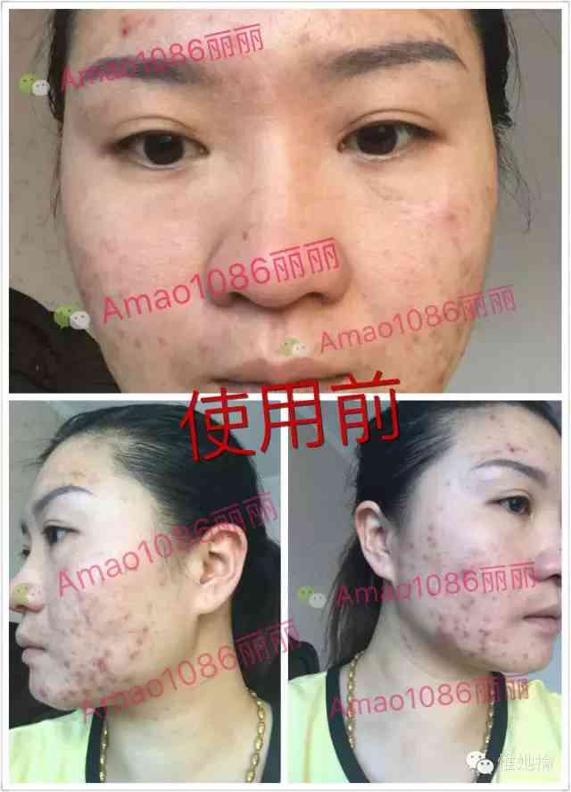 碧玉化妝品是微商嗎(碧肌膚是微商嗎)