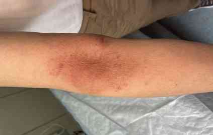 朋友喜歡拿我我化妝品(舍友用我的化妝品)